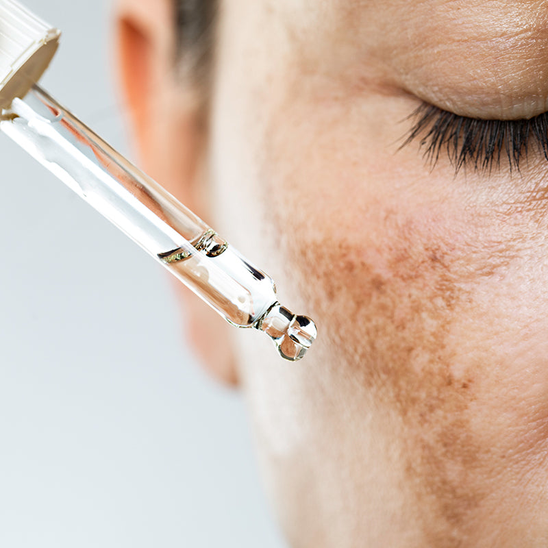 Unhappy Over Hyperpigmentation? Lighten Up and Reclaim Your Skin’s Natural Luminosity!