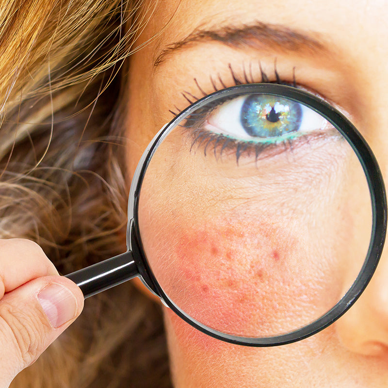 De-stress your Mind, Spirit, and Skin to Fight Inflammation