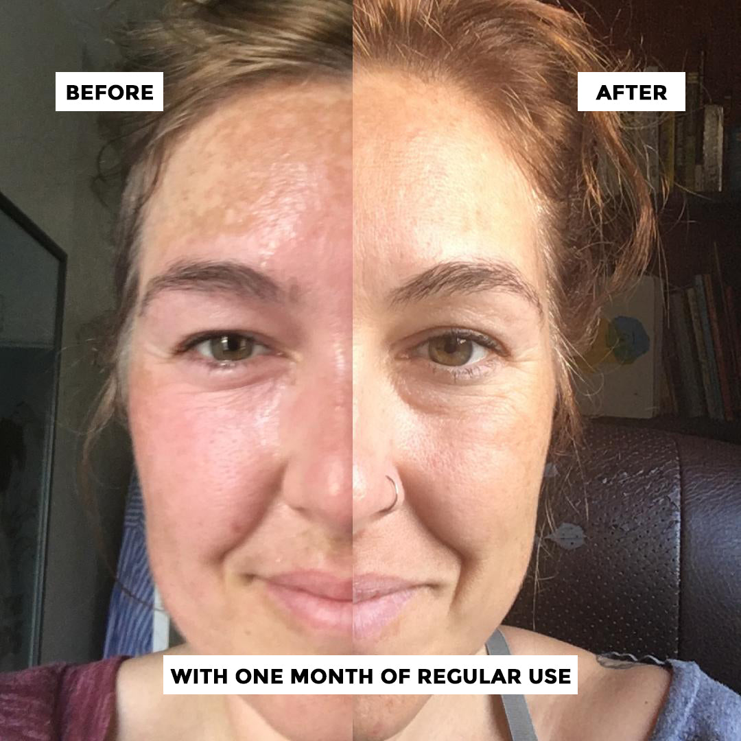 Be Calm - Brightening C Serum